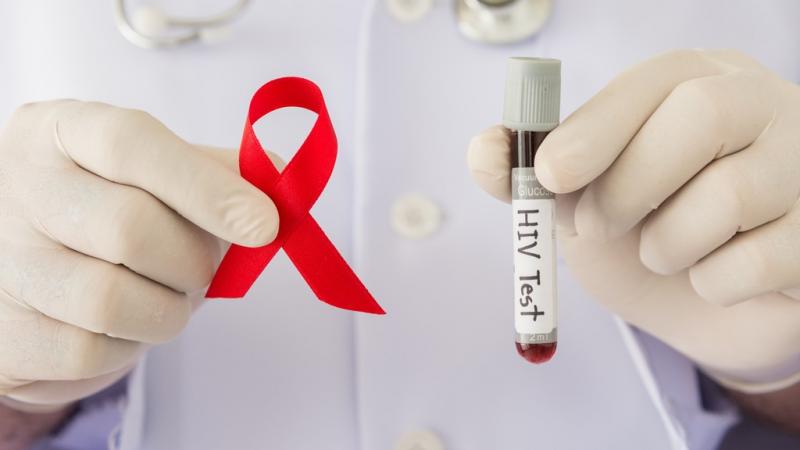 Опыт тестирования на ВИЧ в трудовых коллективах Свердловской области признан наиболее успешным в России
